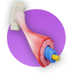 دقت بالا در آنالیز عضلات بدن