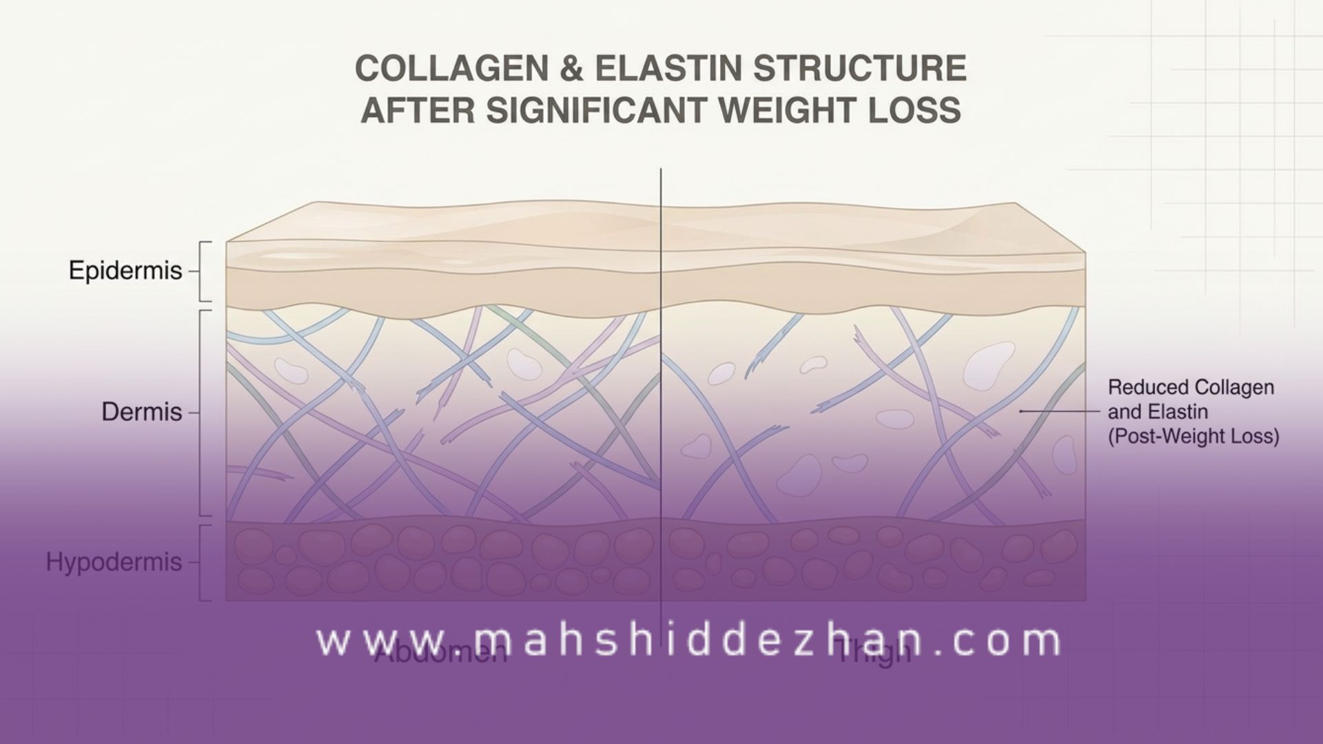 علل اصلی چروک شدن پوست شکم و ران