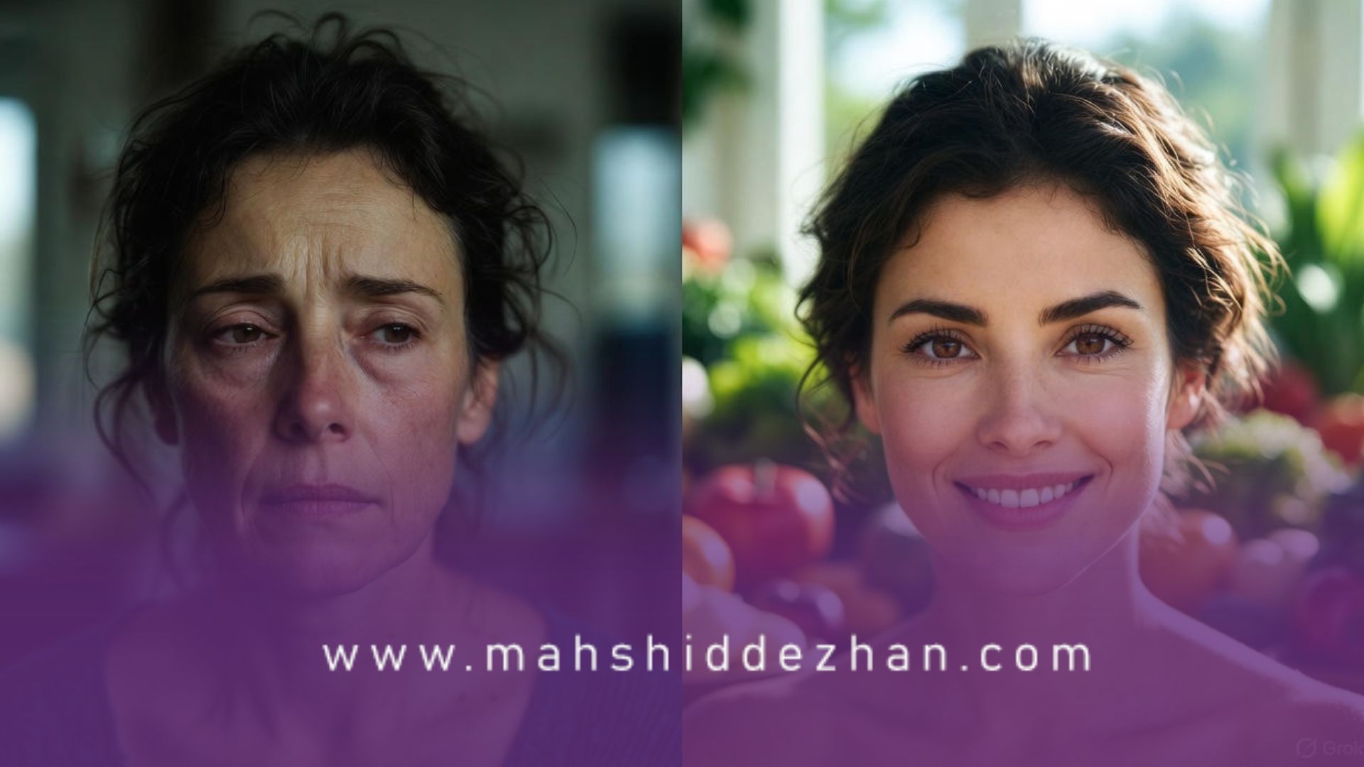 نقش تغذیه در مدیریت PCOS